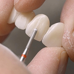 Hands holding a dental bridge